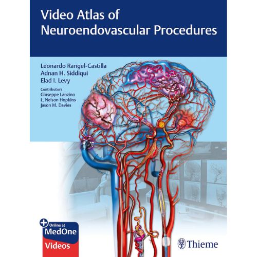 Video Atlas of Neuroendovascular Procedures 1st Edition